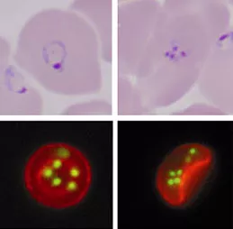 Babesiosis Cells