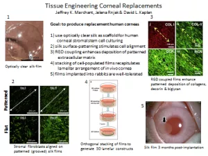 Replacement human cornea